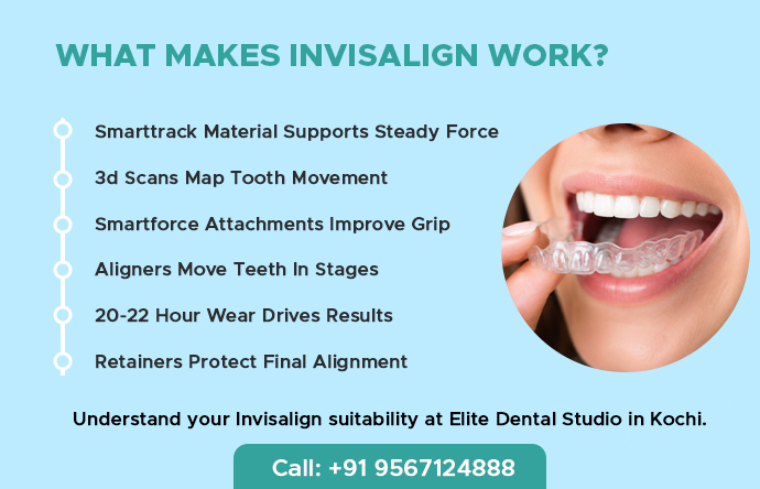 what-makes-invisalign-work