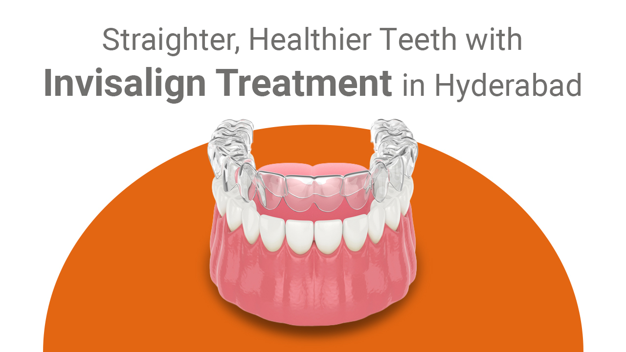 eledent invisalign treatment