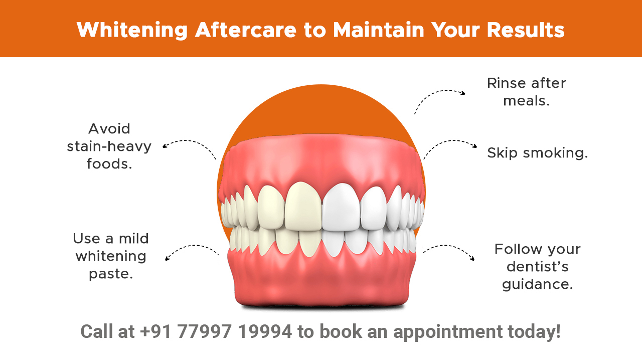 whitening-aftercare-to-maintain-your-results_info