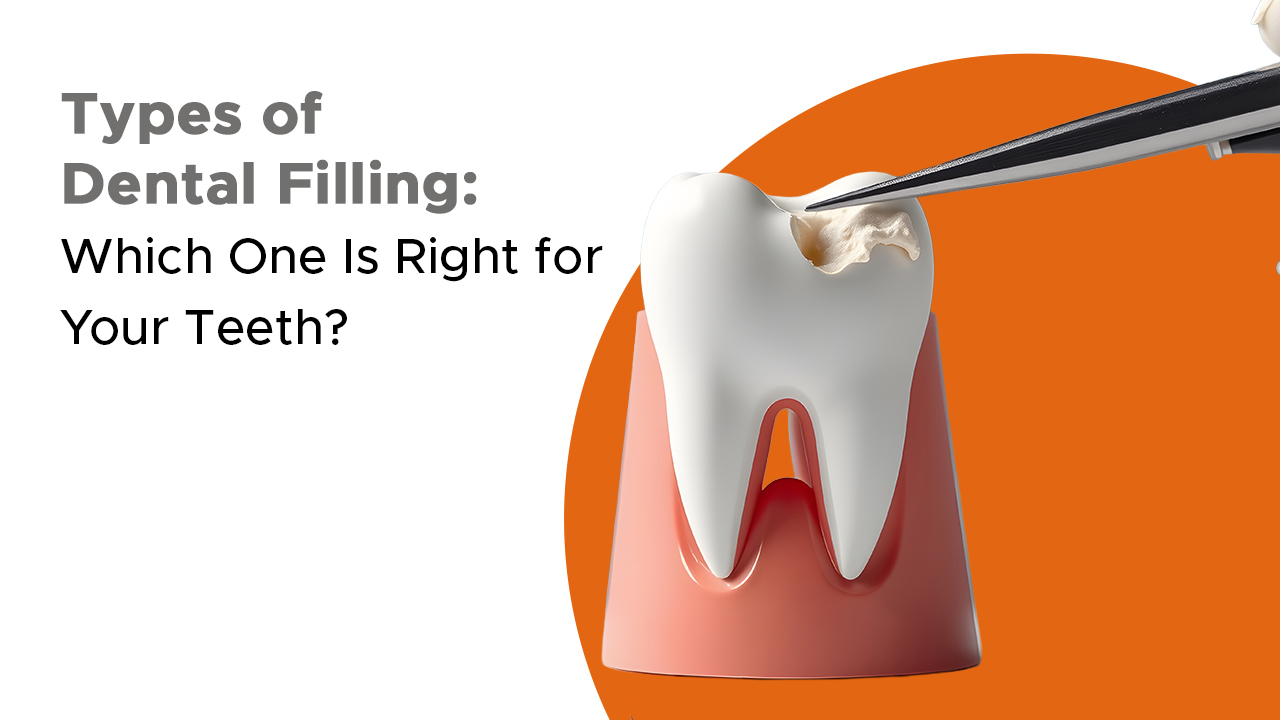 Types of Dental Filling: Which One Is Right for Your Teeth?