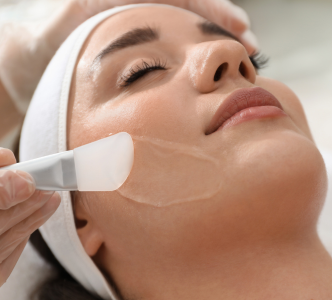 Chemical Peel