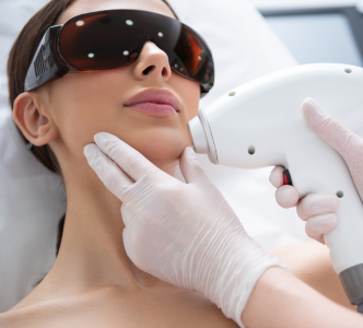 Laser Hair Removal